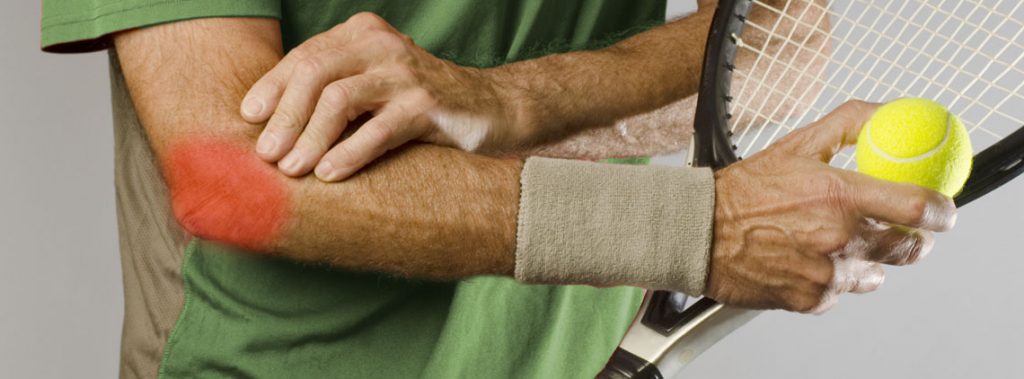 Orlando Hand Surgery Associates | What Causes Tennis Elbow? Orlando Hand Surgery Associates | What Causes Tennis Elbow?